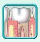 Thumb-periodontal-disease-image