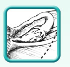 Thumb-laparoscopic-hysterectomy-image